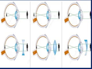 Structure of Eye - Anatomy of Eye PPT presentation | PPTX