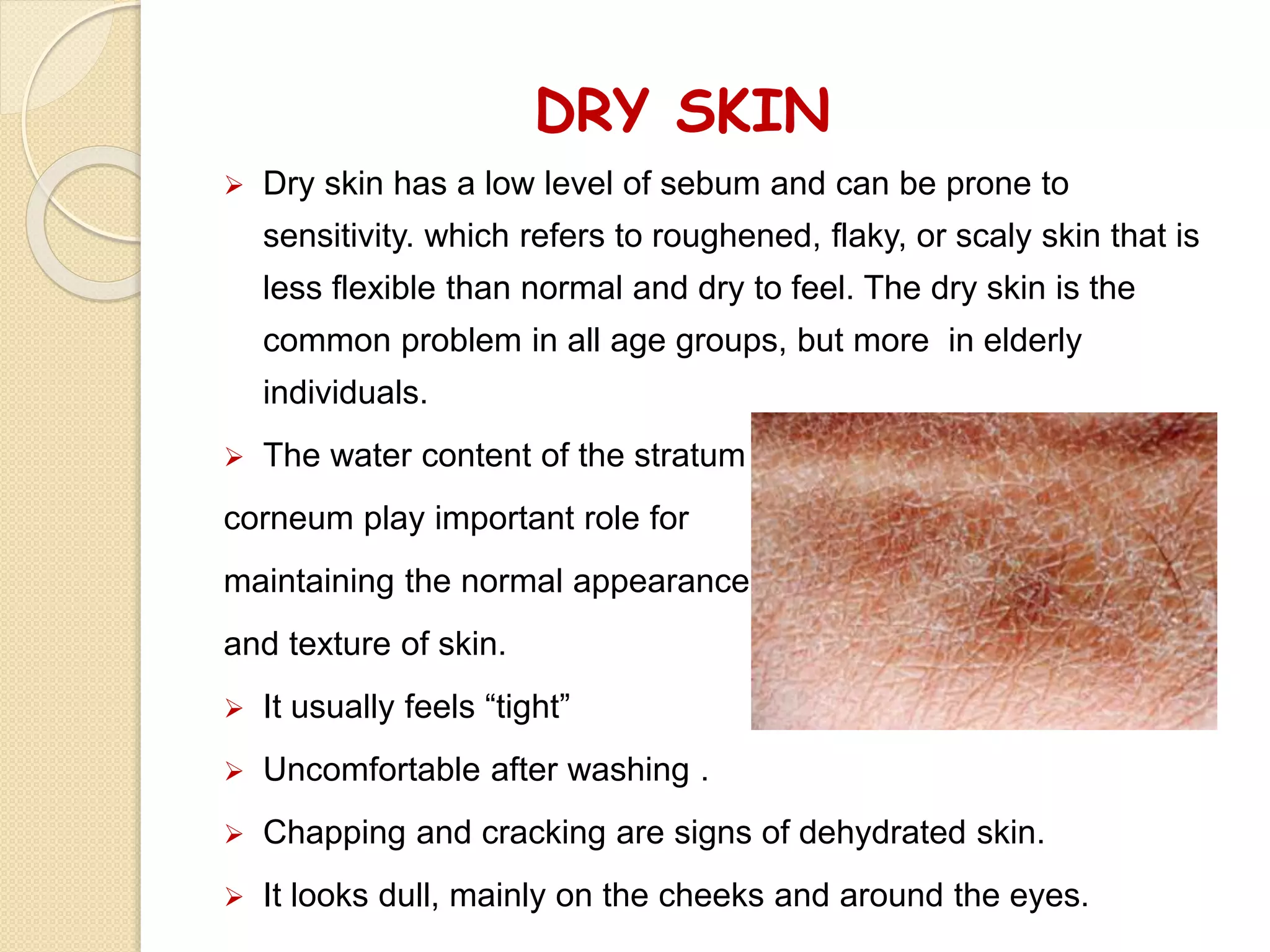 DRY SKIN
 Dry skin has a low level of sebum and can be prone to
sensitivity. which refers to roughened, flaky, or scaly skin that is
less flexible than normal and dry to feel. The dry skin is the
common problem in all age groups, but more in elderly
individuals.
 The water content of the stratum
corneum play important role for
maintaining the normal appearance
and texture of skin.
 It usually feels “tight”
 Uncomfortable after washing .
 Chapping and cracking are signs of dehydrated skin.
 It looks dull, mainly on the cheeks and around the eyes.
 
