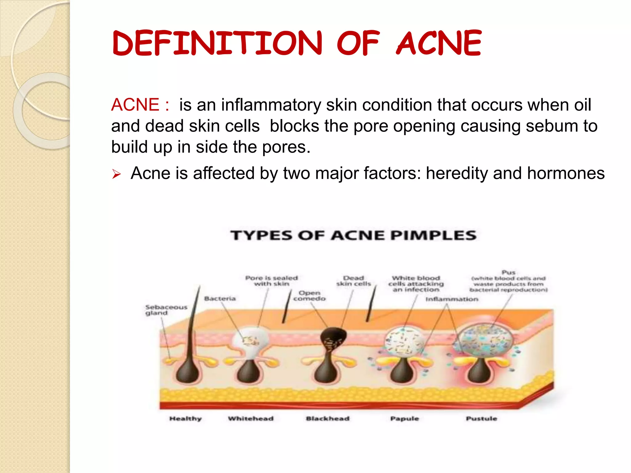 DEFINITION OF ACNE
ACNE : is an inflammatory skin condition that occurs when oil
and dead skin cells blocks the pore opening causing sebum to
build up in side the pores.
 Acne is affected by two major factors: heredity and hormones
 