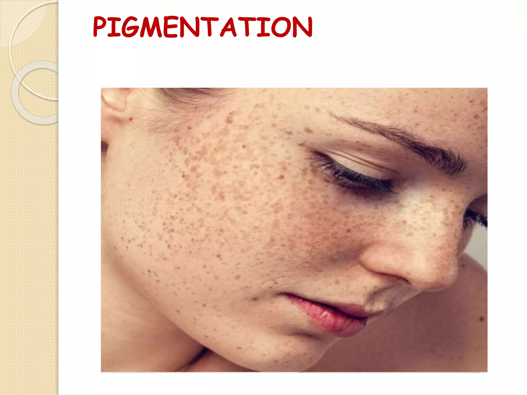 PIGMENTATION
 