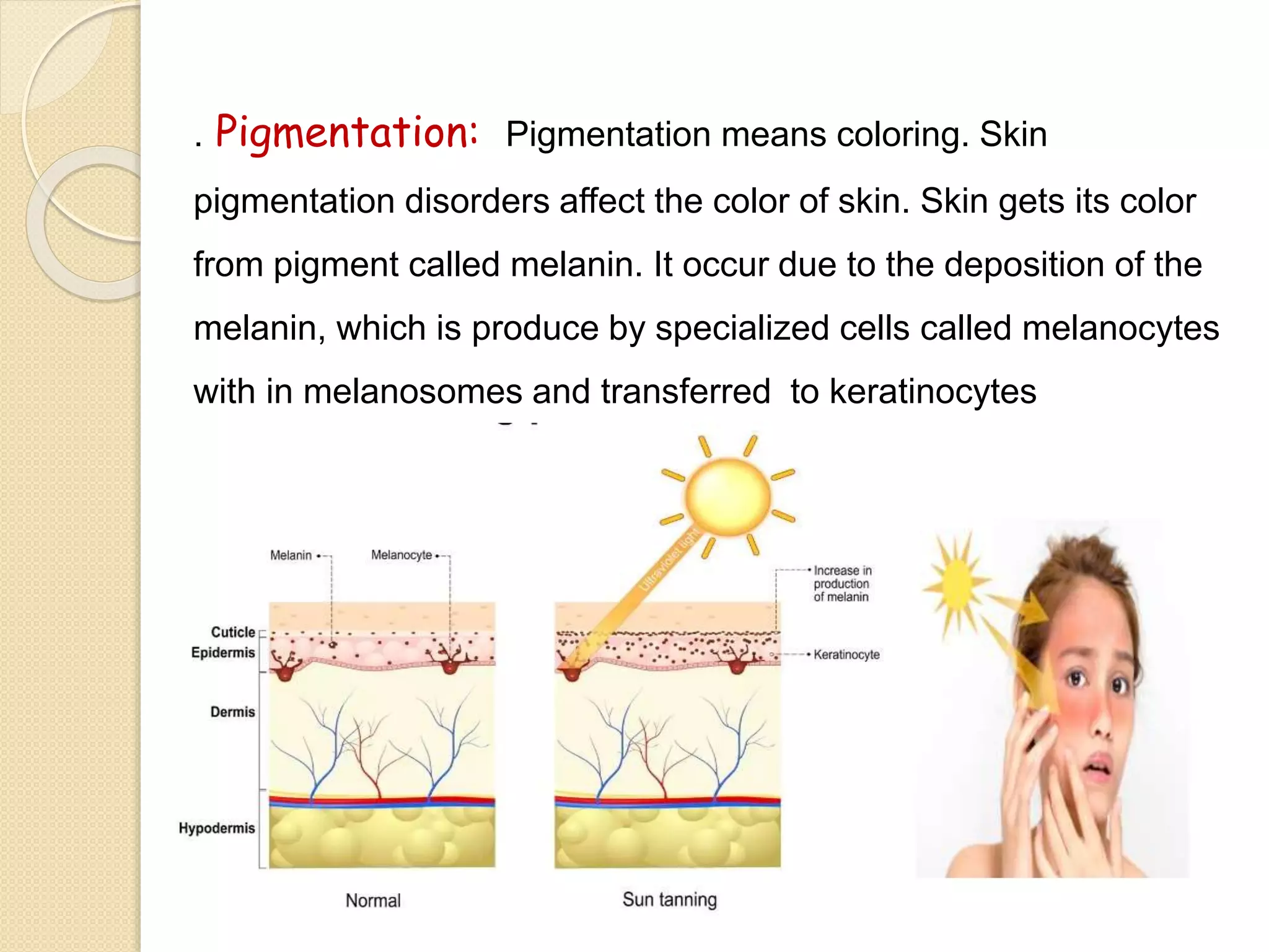 . Pigmentation: Pigmentation means coloring. Skin
pigmentation disorders affect the color of skin. Skin gets its color
from pigment called melanin. It occur due to the deposition of the
melanin, which is produce by specialized cells called melanocytes
with in melanosomes and transferred to keratinocytes
 