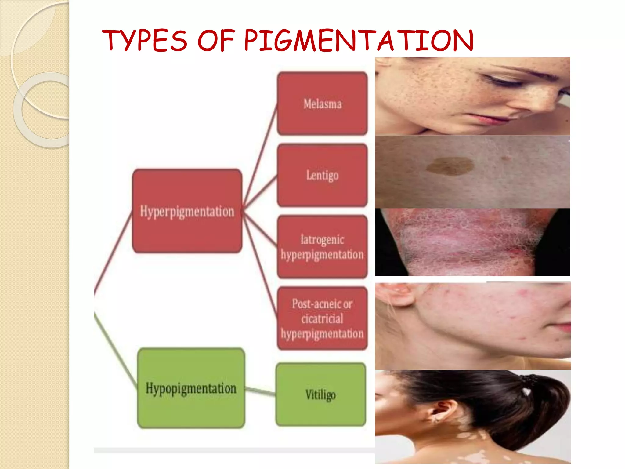 TYPES OF PIGMENTATION
 