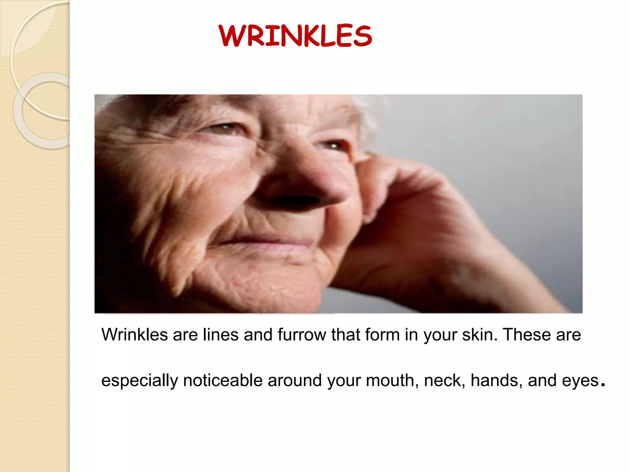 WRINKLES
Wrinkles are lines and furrow that form in your skin. These are
especially noticeable around your mouth, neck, hands, and eyes.
 