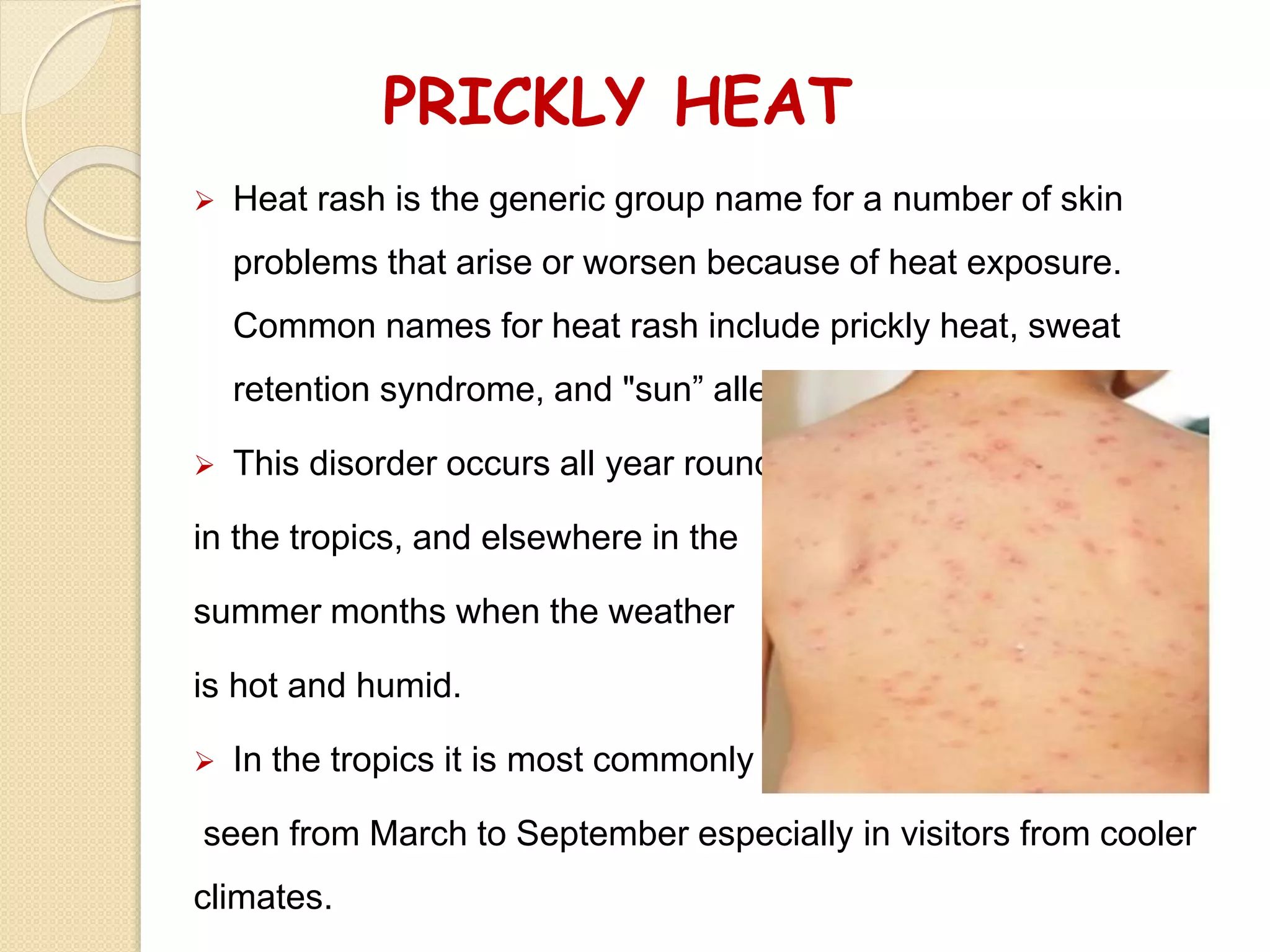 Friction Rash Structure of skin and skin relating problems | PDF
