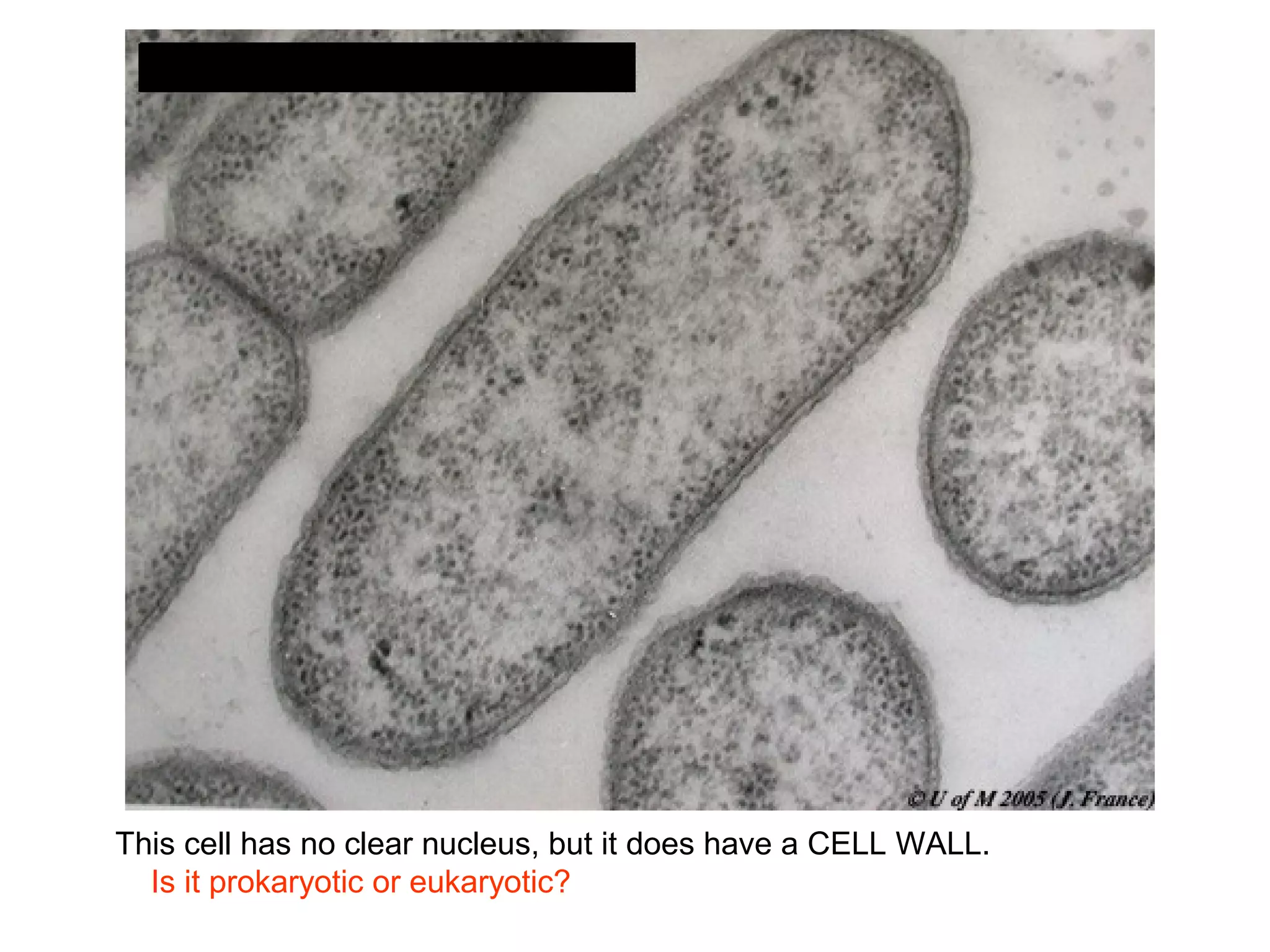 This cell has no clear nucleus, but it does have a CELL WALL.
  Is it prokaryotic or eukaryotic?
 
