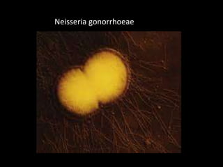 Neisseria gonorrhoeae

 