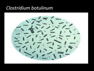 Clostridium botulinum

 