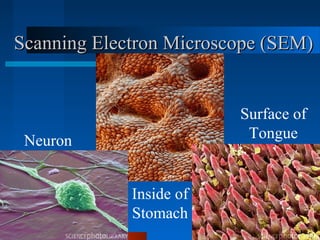 Scanning Electron Microscope (SEM)Scanning Electron Microscope (SEM)
Inside of
Stomach
Surface of
TongueNeuron
 