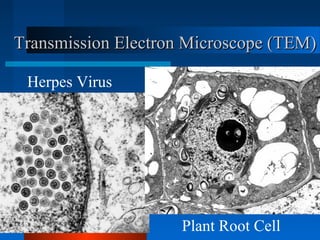 Transmission Electron Microscope (TEM)Transmission Electron Microscope (TEM)
Herpes Virus
Plant Root Cell
 