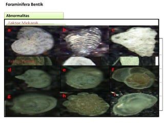 Foraminifera Bentik
Test Foraminifera bentikDinding Test ForaminiferaApertur ForaminiferaOrnamentasi Foraminifera
Ornamentasi pada Foraminifera bentik yang berada di
Teluk Lampung, (a) Ornamentasi keel pada Elphidium,
(b) Oranmentasi spinose pada Calcarina (Penyusun, 2016)
Warna Test Foraminifera
Warna test Foraminifera bentik yang berada di Teluk Lampung,
(a).Test calcareous Ammonia berwarna coklat, (b).Test porsellenous
Quinqueloculina berwarna putih opak dan (c).Test aggulitin
Textularia berwarna abu-abu (Penyusun, 2016)
Abnormalitas
 