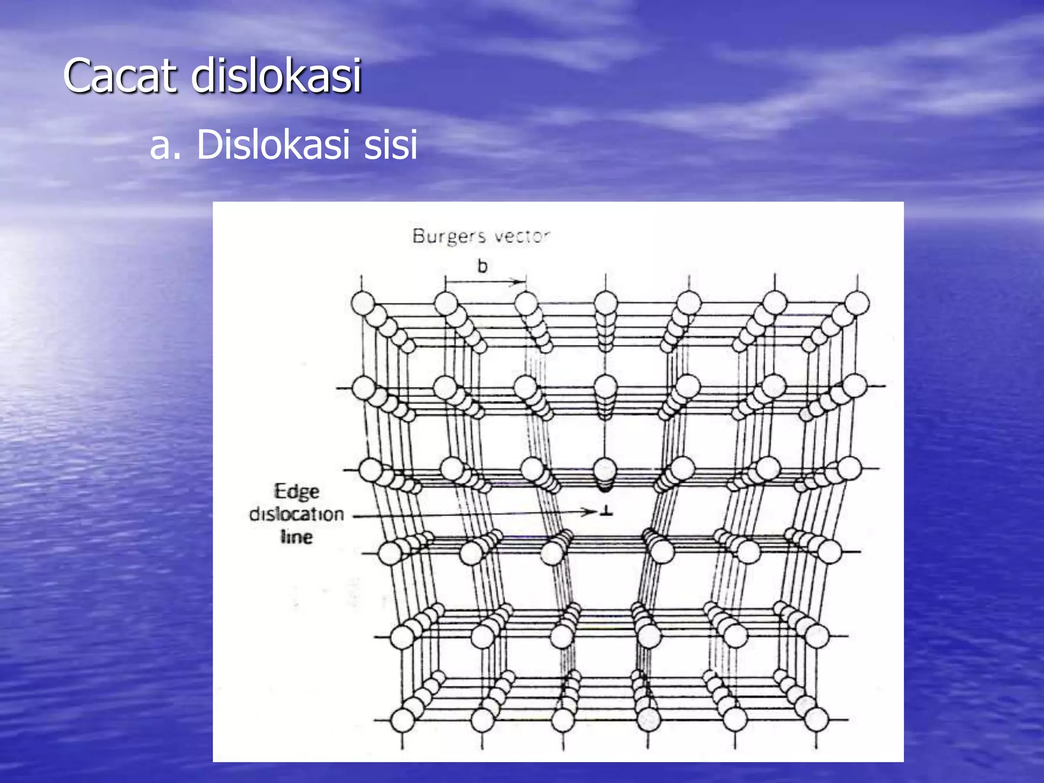 Cacat dislokasi
a. Dislokasi sisi
 