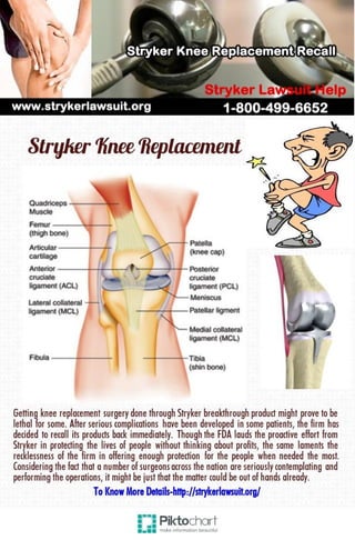 Stryker knee replacement