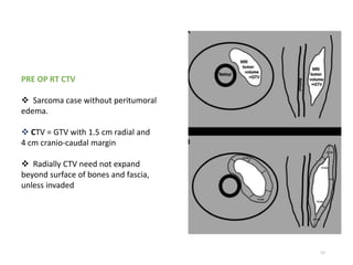 57
PRE OP RT CTV
 Sarcoma case without peritumoral
edema.
 CTV = GTV with 1.5 cm radial and
4 cm cranio-caudal margin
 Radially CTV need not expand
beyond surface of bones and fascia,
unless invaded
 