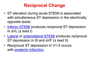 Reciprocal Change
• ST elevation during acute STEMI is associated
with simultaneous ST depression in the electrically
opposite leads:
• Inferior STEMI produces reciprocal ST depression
in aVL (± lead I)
• Lateral or anterolateral STEMI produces reciprocal
ST depression in III and aVF (± lead II)
• Reciprocal ST depression in V1-3 occurs
with posterior infarction
 