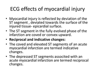 ECG effects of myocardial injury
• Myocardial injury is reflected by deviation of the
ST segment , deviated towards the surface of the
injured tissue- epicardial surface.
• The ST segment in the fully evolved phase of the
infarction are coved or convex upward.
• Reciprocal and indicative changes:
• The coved and elevated ST segments of an acute
myocardial infarction are termed indicative
changes.
• The depressed ST segments associted with an
acute myocardial infarction are termed reciprocal
changes.
 