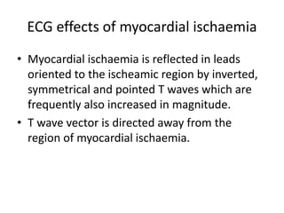 ECG effects of myocardial ischaemia
• Myocardial ischaemia is reflected in leads
oriented to the ischeamic region by inverted,
symmetrical and pointed T waves which are
frequently also increased in magnitude.
• T wave vector is directed away from the
region of myocardial ischaemia.
 