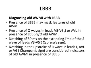 LBBB
Diagnosing old AWMI with LBBB
• Presence of LBBB may mask features of old
AWMI.
• Presence of Q waves in leads V5-V6 ,I or AVL in
presence of LBBB S/O old AWMI.
• Notching of 50 ms on the ascending limd of the S
wave of leads V3-V5 ( Cabrera’s sign).
• Notching in the upstroke of R wave in leads I, AVL
or V6 ( Champan’s sign) are considered indicators
of old AWMI in presence of LBBB.
 