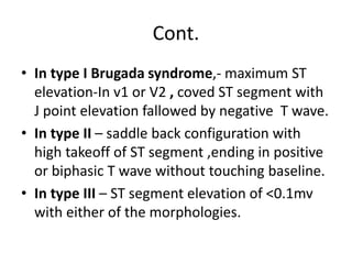 Cont.
• In type I Brugada syndrome,- maximum ST
elevation-In v1 or V2 , coved ST segment with
J point elevation fallowed by negative T wave.
• In type II – saddle back configuration with
high takeoff of ST segment ,ending in positive
or biphasic T wave without touching baseline.
• In type III – ST segment elevation of <0.1mv
with either of the morphologies.
 