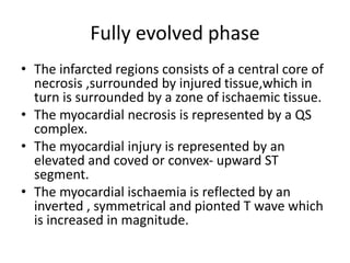 Fully evolved phase
• The infarcted regions consists of a central core of
necrosis ,surrounded by injured tissue,which in
turn is surrounded by a zone of ischaemic tissue.
• The myocardial necrosis is represented by a QS
complex.
• The myocardial injury is represented by an
elevated and coved or convex- upward ST
segment.
• The myocardial ischaemia is reflected by an
inverted , symmetrical and pionted T wave which
is increased in magnitude.
 