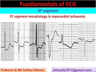 Approach to a patient with ST segment abnormality in ECG | PPSX