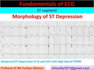Approach to a patient with ST segment abnormality in ECG | PPSX