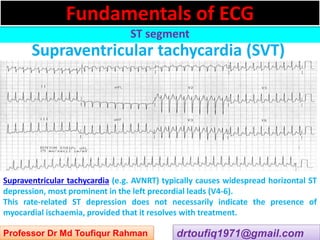 Approach to a patient with ST segment abnormality in ECG | PPSX