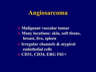 Angiosarcoma
 Malignant vascular tumor
 Many locations: skin, soft tissue,
breast, live, spleen
 Irregular channels & atypical
endothelial cells
 CD31, CD34, ERG Fli1+
 