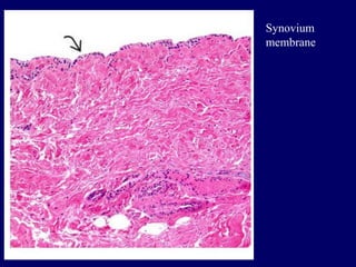 Synovium
membrane
 