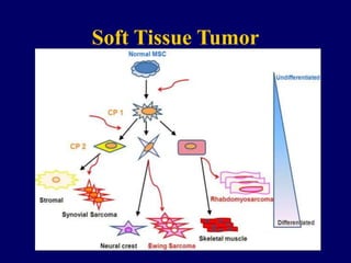 Soft Tissue Tumor
Neoplastic conditions arising in
extraskeletal mesodermal tissues
-- Skeletal muscle
-- Fibrous tissue
-- Smooth muscle
-- Blood & lymphatic vessels
-- Peripheral nerves - neuroectoderm
-- Adipose tissue
 