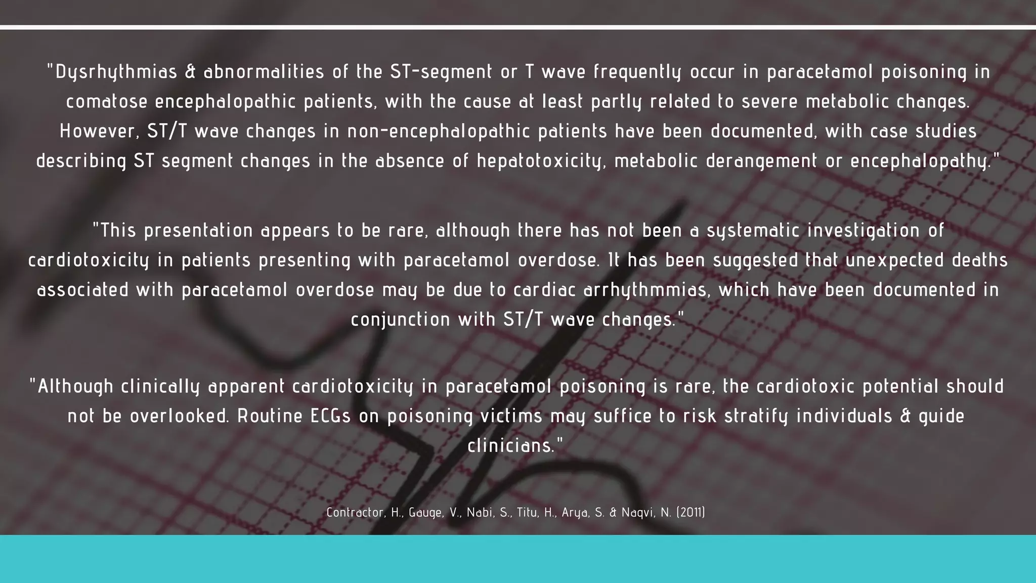 St t wave abnormalities in paracetamol [acetaminophen] overdose | PDF