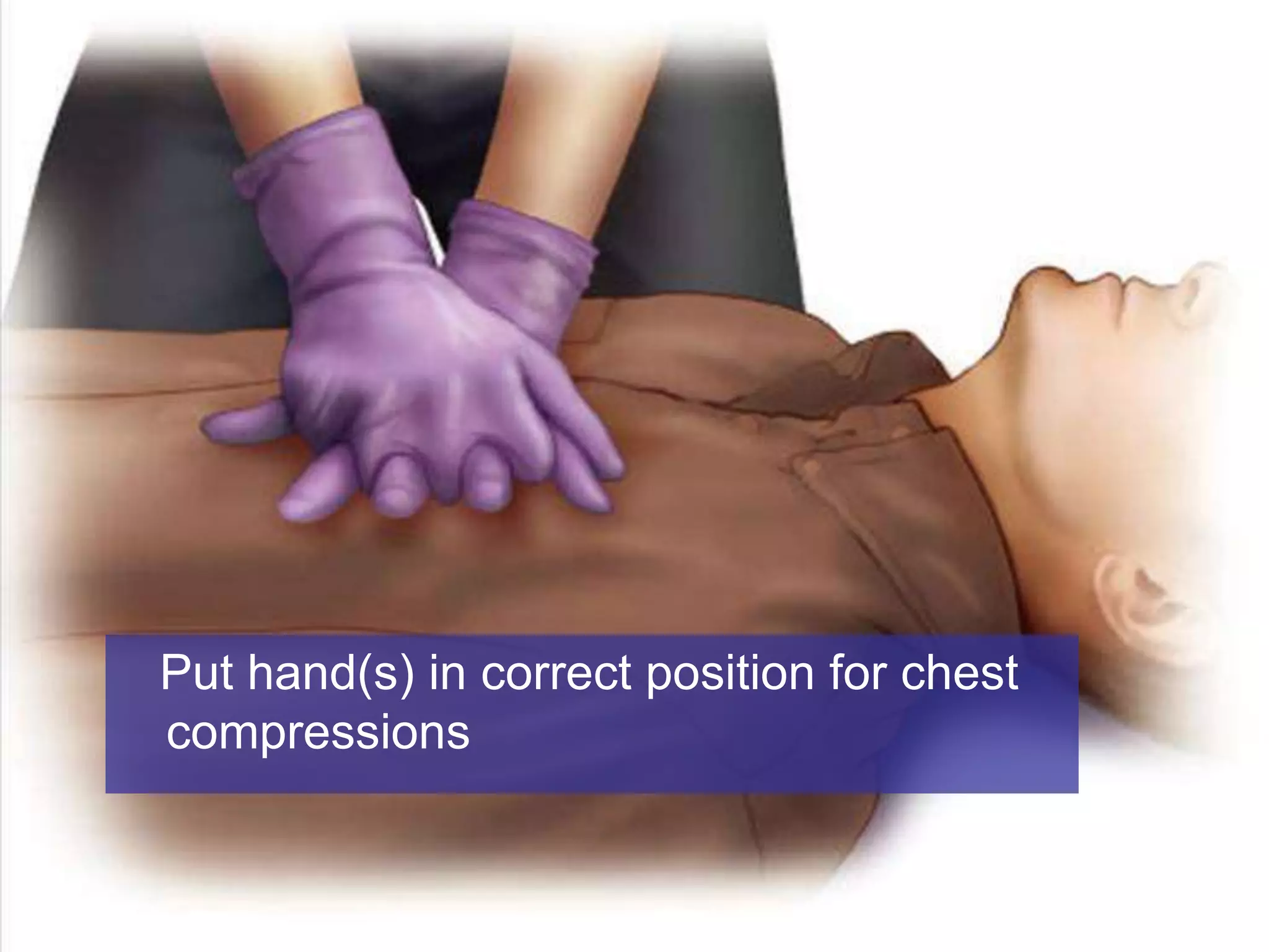 Put hand(s) in correct position for chest
compressions
 