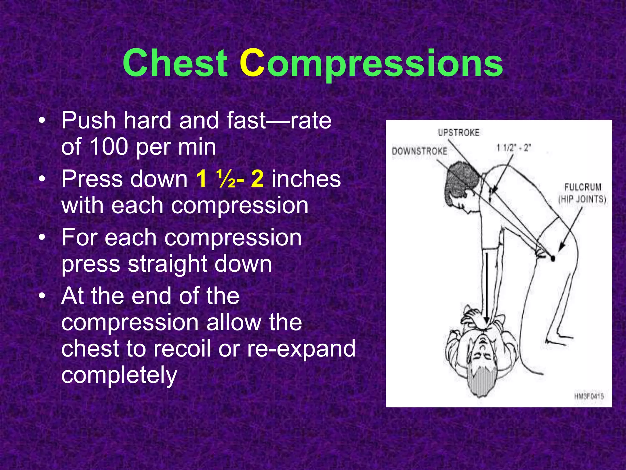 Chest Compressions
• Push hard and fast—rate
of 100 per min
• Press down 1 ½- 2 inches
with each compression
• For each compression
press straight down
• At the end of the
compression allow the
chest to recoil or re-expand
completely
 