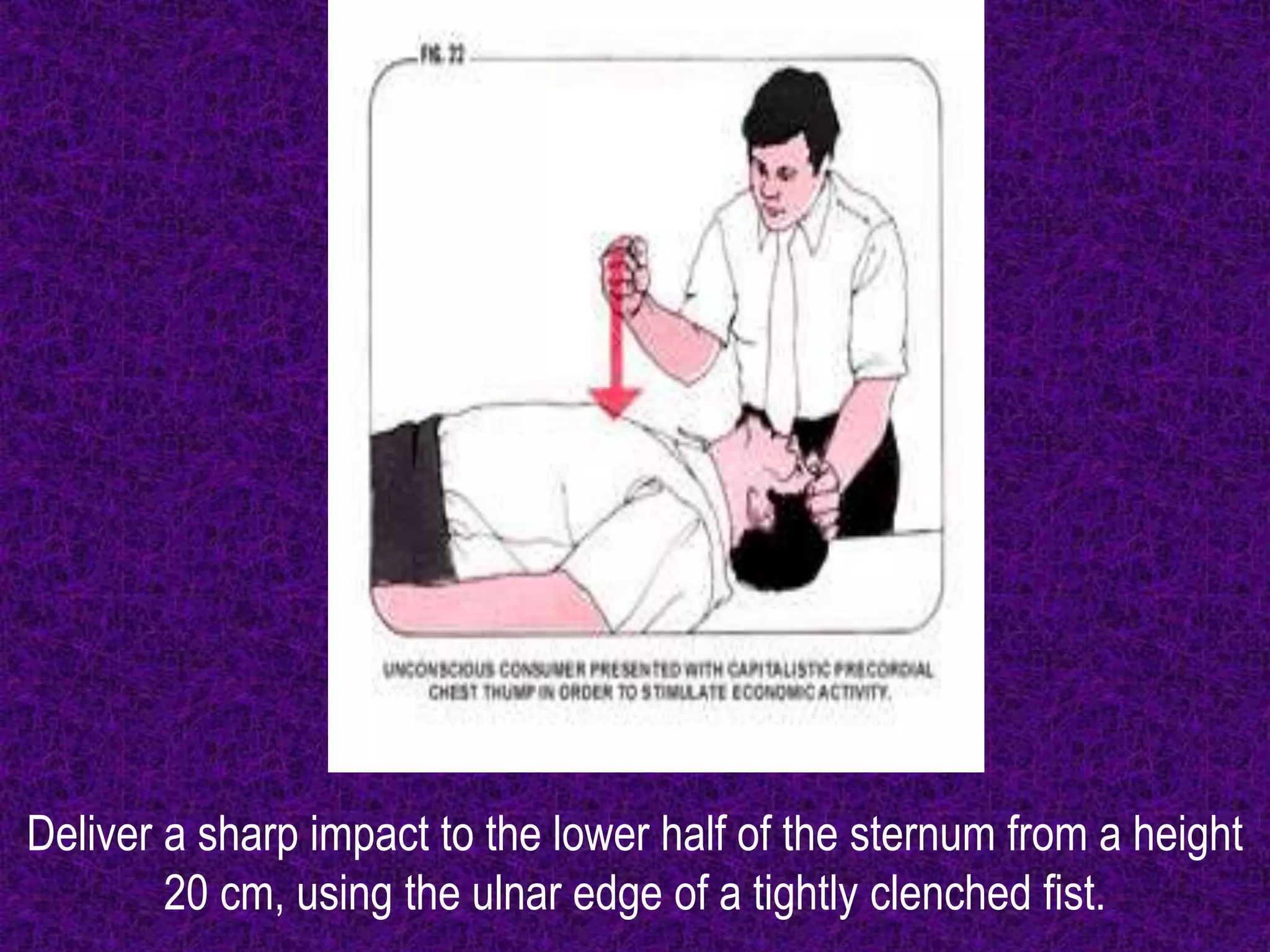 Deliver a sharp impact to the lower half of the sternum from a height
20 cm, using the ulnar edge of a tightly clenched fist.
 