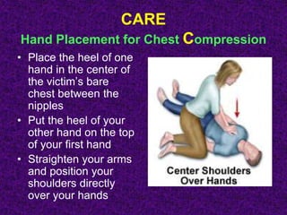 CARE
Hand Placement for Chest Compression
• Place the heel of one
hand in the center of
the victim’s bare
chest between the
nipples
• Put the heel of your
other hand on the top
of your first hand
• Straighten your arms
and position your
shoulders directly
over your hands
 
