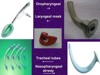 Oropharyngeal

Laryngeal mask

Tracheal tubes
Nasopharyngeal
airway
 