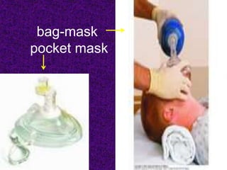 bag-mask
pocket mask
 