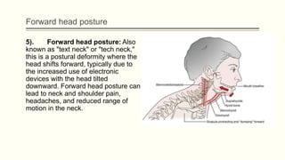 Forward head posture
5). Forward head posture: Also
known as "text neck" or "tech neck,"
this is a postural deformity where the
head shifts forward, typically due to
the increased use of electronic
devices with the head tilted
downward. Forward head posture can
lead to neck and shoulder pain,
headaches, and reduced range of
motion in the neck.
 