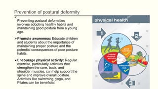 Prevention of postural deformity

Preventing postural deformities
involves adopting healthy habits and
maintaining good posture from a young
age.
Promote awareness: Educate children
and students about the importance of
maintaining proper posture and the
potential consequences of poor posture
habits.
Encourage physical activity: Regular
exercise, particularly activities that
strengthen the core, back, and
shoulder muscles, can help support the
spine and improve overall posture.
Activities like swimming, yoga, and
Pilates can be beneficial.
 