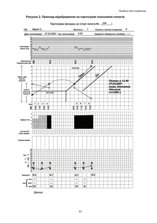 Посібник для студентів

Рисунок 2. Приклад відображення на партограмі показників пологів

91

 