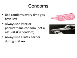 Condoms
• Use condoms every time you
have sex
• Always use latex or
polyurethane condom (not a
natural skin condom)
• Always use a latex barrier
during oral sex
 