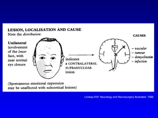 Students Facial Weakness | PPT