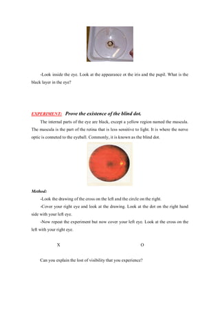 -Look inside the eye. Look at the appearance ot the iris and the pupil. What is the
black layer in the eye?
EXPERIMENT: Prove the existence of the blind dot.
The internal parts of the eye are black, except a yellow region named the mascula.
The mascula is the part of the retina that is less sensitive to light. It is where the nerve
optic is conneted to the eyeball. Commonly, it is known as the blind dot.
Method:
-Look the drawing of the cross on the left and the circle on the right.
-Cover your right eye and look at the drawing. Look at the dot on the right hand
side with your left eye.
-Now repeat the experiment but now cover your left eye. Look at the cross on the
left with your right eye.
X O
Can you explain the lost of visibility that you experience?
 