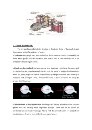 4.-Vision’s anomalies.
The eye can have defects in its structure or functions. Some of these defects can
be corrected with different types of lenses:
-Presbyopia: Old people have a crystalline lens that is less elastic and it can’t modify its
form. These people have to step back from text to read it. This anomaly has to be
corrected with convergent lenses.
-Myopia or short-sightedless: Some people have shortened eyesight or the cornea and
crystalline lens are curved too much. In this case, the image is projected in front of the
retina. So, these people can’t see it formed correctly at larger distances. This anomaly is
corrected with divergent lenses, because they have to move closer to the image to
project it on the cornea.
-Hypermetropia or long-sightedness: The images are formed behind the retina because
people with this anomay have lengthened eyesight. Either that or the cornea or
crystalline lens isn’t curved enough. People with this anomaly can’t see correctly at
short distances. It can be corrected with convergent lenses.
 