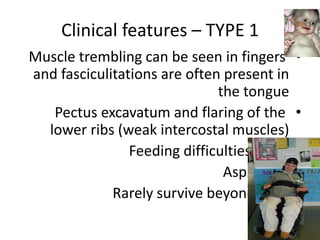 Clinical features – TYPE 1
•
Muscle trembling can be seen in fingers
and fasciculitations are often present in
the tongue
•
Pectus excavatum and flaring of the
lower ribs (weak intercostal muscles)
•
Feeding difficulties – FTT
•
Aspiration
•
Rarely survive beyond 2 yrs
 