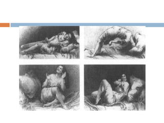 This is the reason why Freud associates hysteria with sexual events: only these, he believes, carry enough traumatic force to stigmatize us to the point of creating a hysterical response.“We found at first to our greatest surprise, that the individual hysterical symptoms immediately disappeared without returning if we succeed in thoroughly awakening the memories of the causal process with its accompanying affect, and if the patient circumstantially discussed the process in the most detailed manner and gave verbal expressions to the affect.”