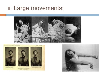 2. If in somnambulistic states the reaction to traumata is also reduced to nil.3. There appears that general blurring of impressions and the fading of memory (forgetting) and which above all wears out the affective ideas no longer activated.