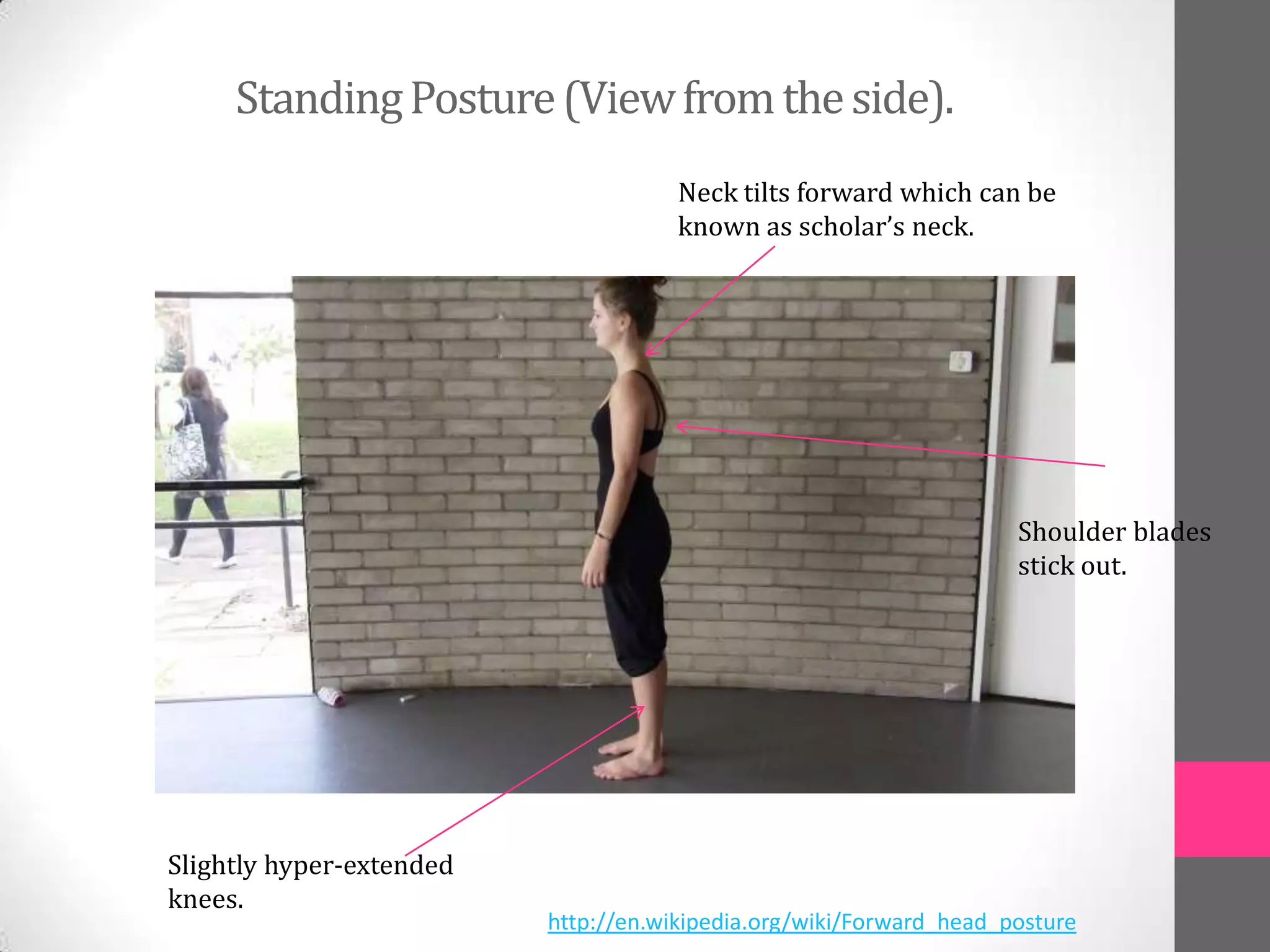 Standing Posture (View from the side).
                                      Neck tilts forward which can be
                                      known as scholar’s neck.




                                                                     Shoulder blades
                                                                     stick out.




Slightly hyper-extended
knees.
                          http://en.wikipedia.org/wiki/Forward_head_posture
 
