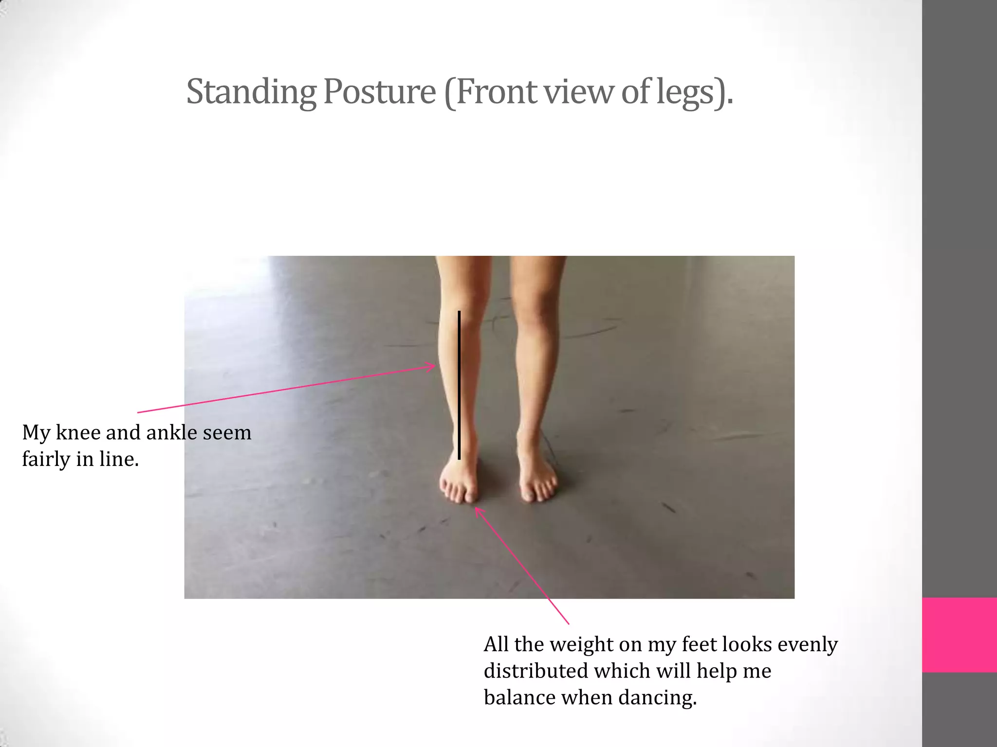Standing Posture (Front view of legs).




My knee and ankle seem
fairly in line.




                                   All the weight on my feet looks evenly
                                   distributed which will help me
                                   balance when dancing.
 