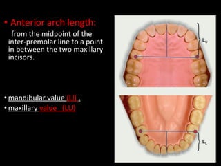 Model analysis in orthodontic | PPT
