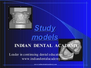 Study
models
INDIAN DENTAL ACADEMY
Leader in continuing dental education
www.indiandentalacademy.com
www.indiandentalacademy.com

 